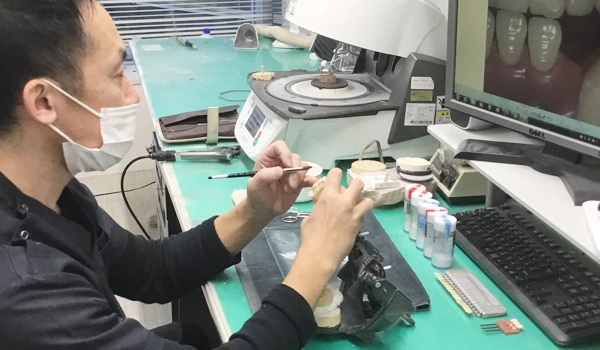 セラミックの歯【画像】