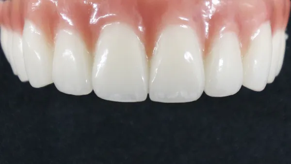 セラミックの歯【画像】