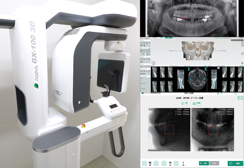 3DComputed Tomography