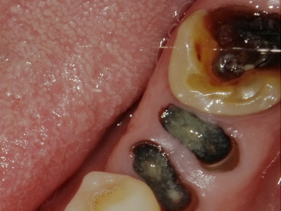 幅広い症例への対応力