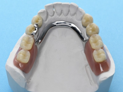 入れ歯が合わない