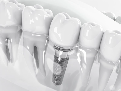 予算を抑えたい