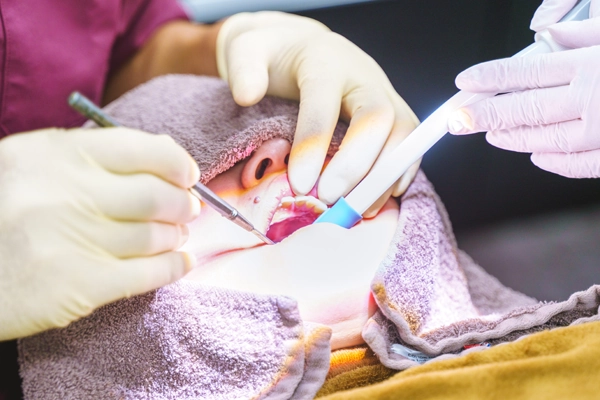 インプラントの手術について【画像】