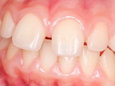 入れ歯が合わない