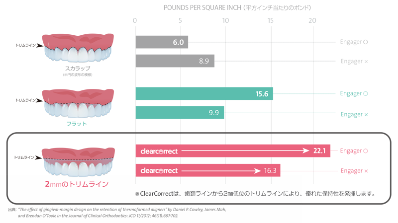 2mmのトリムライン