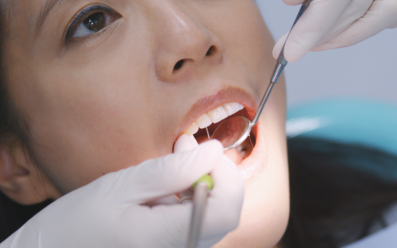 インプラントの歯の寿命はどのくらい？