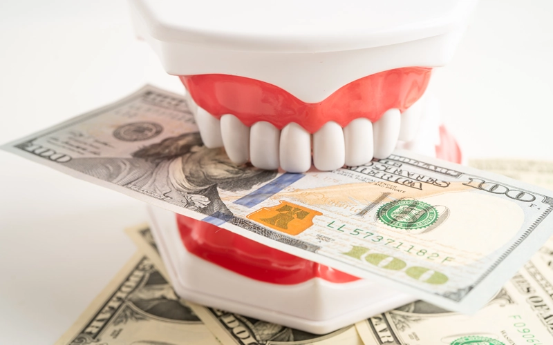 インプラントの相場は？費用の目安・治療内容・注意点を徹底解説【画像】