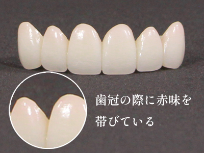 桜ジルコニアセラミック